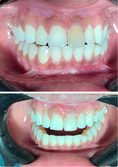antes-depois-02