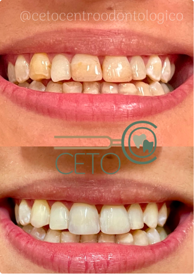 antes-depois-03