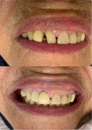 antes-depois-04