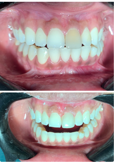 antes-depois-05